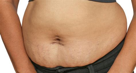 ���ǲ���ָ�����