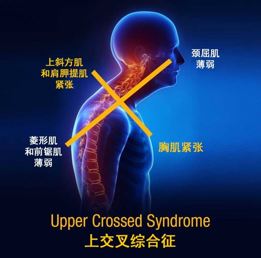 �����˶�����