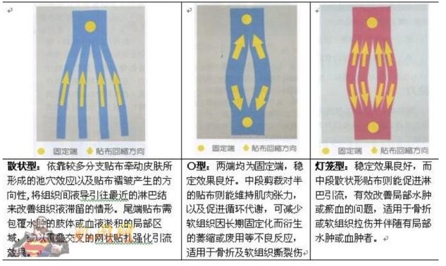 �����˶�����