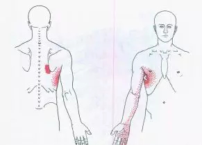 �����˶�����