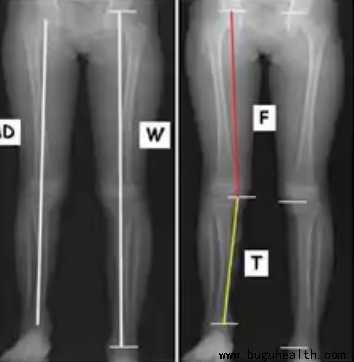 �������ģ�������