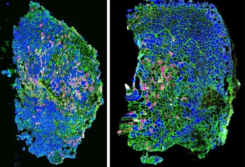 �����˶�����