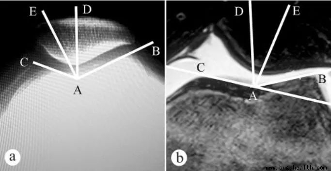 �ƹ�����,�������ǿ�������