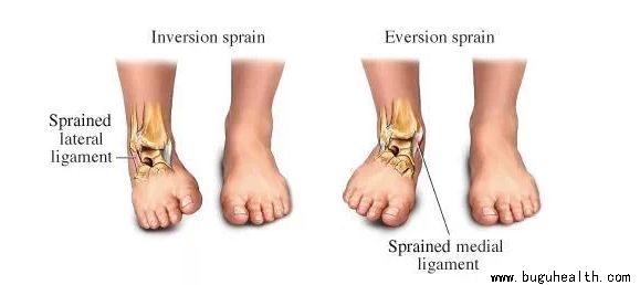 ϰ�����˽�,���ǿ���