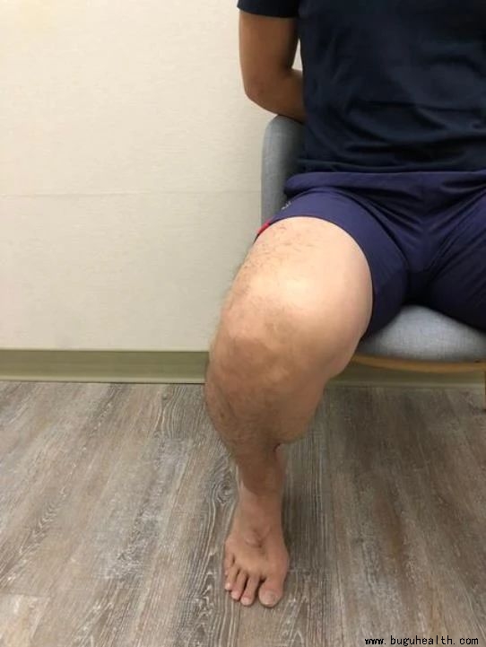 ����,Ĵָ�ⷭ