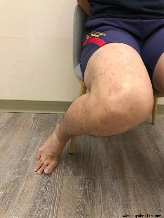 ����,Ĵָ�ⷭ