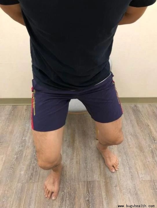 ����,Ĵָ�ⷭ