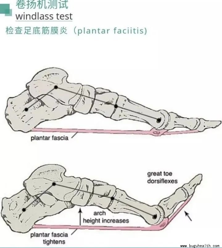 ��׽�Ĥ�ף����ʹ������