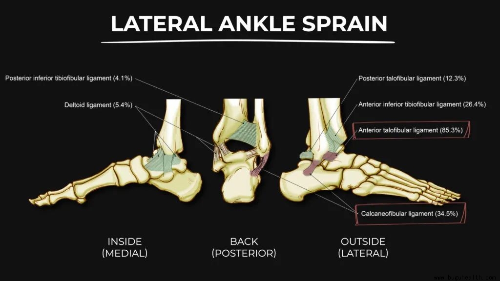 ���ǣ��׹ؽ�Ť�ˣ������׹ؽڲ���