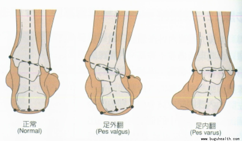 ���ǣ��������ˣ����׿���