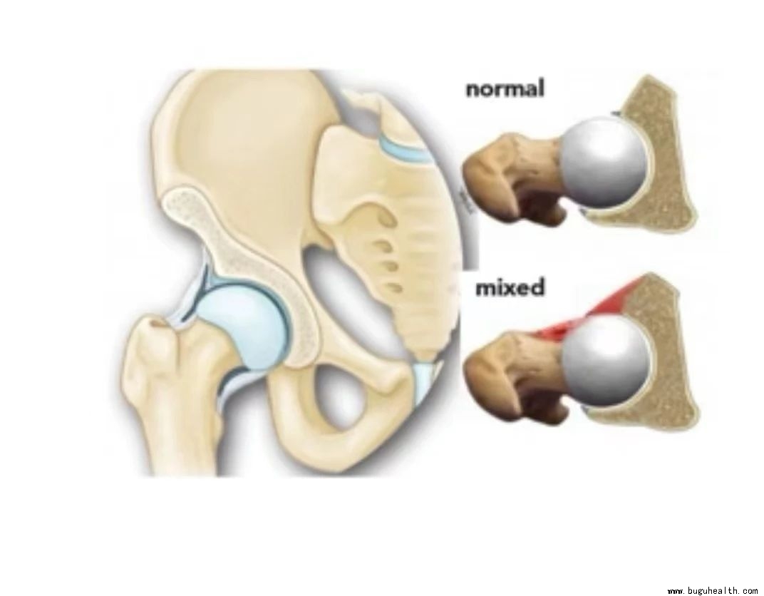 �Źؽ�ײ���ۺ���������