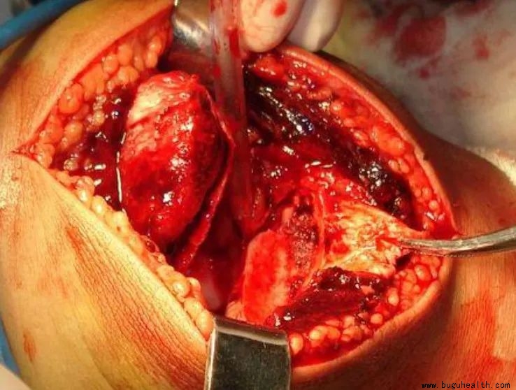 ϥ�ؽڿ�������ǰ����