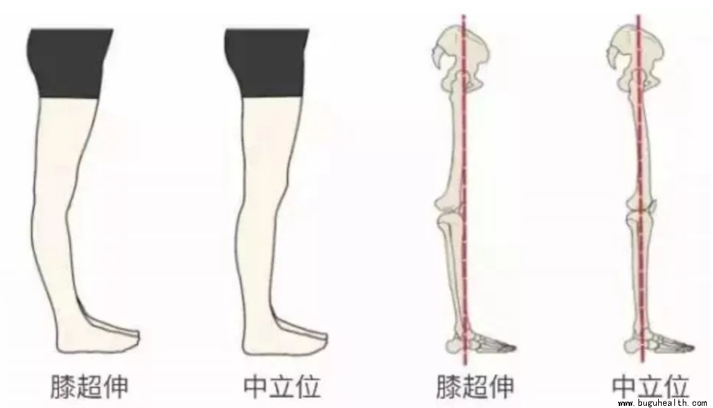 布骨医学科普、膝关节、布骨康复 布骨医学科普、膝关节、布骨康复