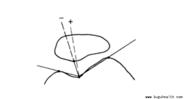 ����ҽѧ���ա����ǿ��������ǿ���