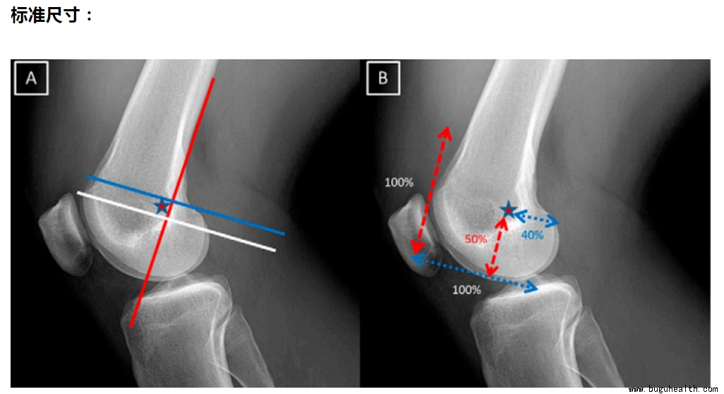 �������ǿ�������