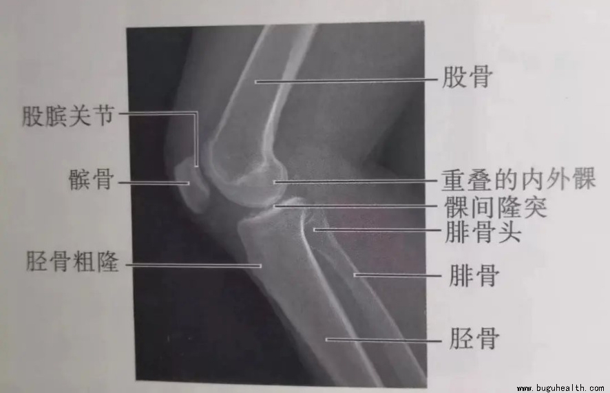 布骨医学科普、肌骨康复、布骨康复、膝关节损伤 布骨医学科普、肌骨康复、布骨康复、膝关节损伤