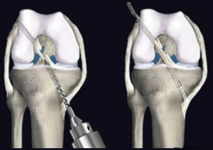 ǰ�����ʹ�����