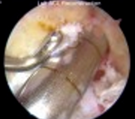 ǰ���ؽ�����