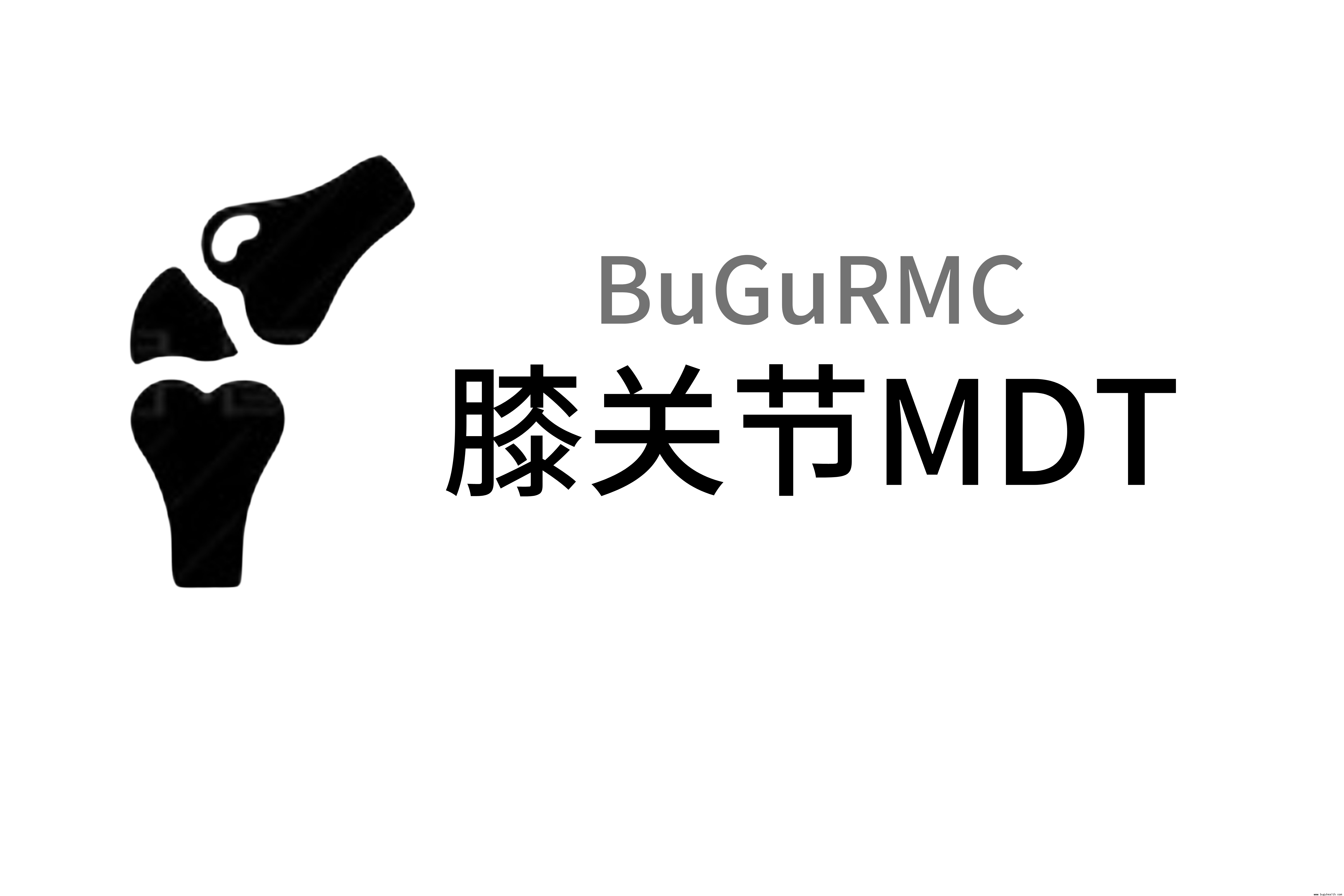 ���Ǽ�ؽ�MDT